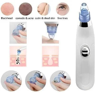 Dead Skin Remover Black Head Remover