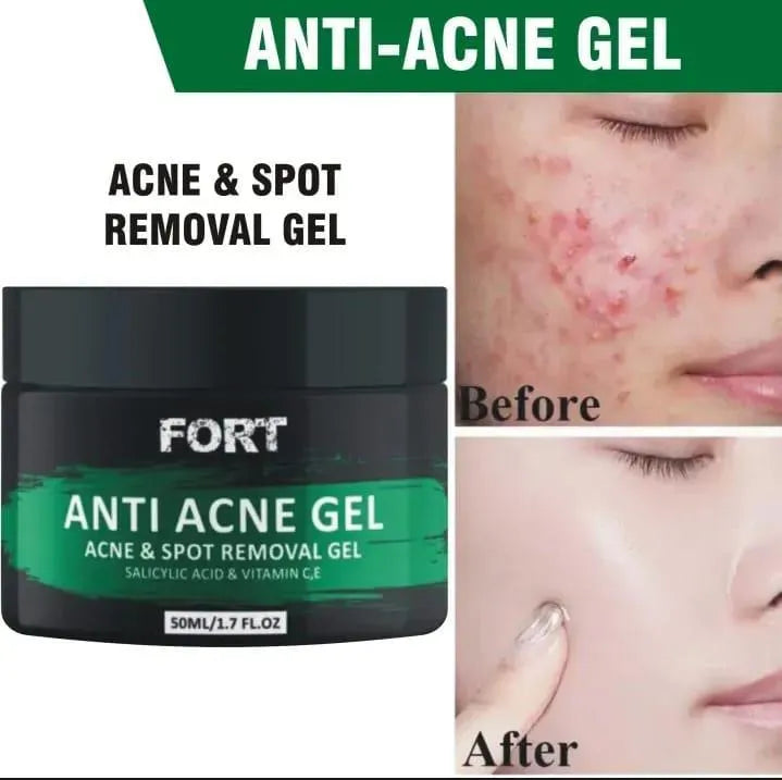 Fort Acne Exfoliator Exfoliating Gel