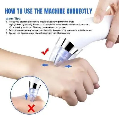 Dead Skin Remover Black Head Remover