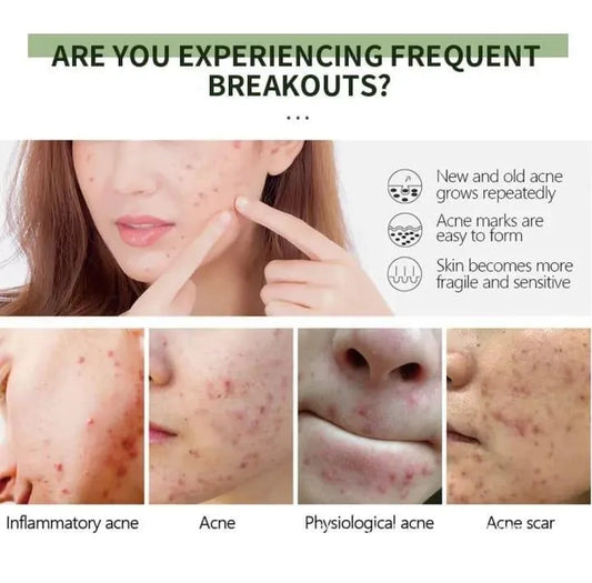 Fort Acne Exfoliator Exfoliating Gel